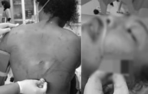 Dua Warga Padang Diamuk Geng Petarung Saat Cegah Tawuran