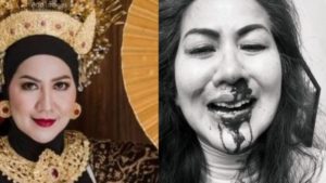 Venna Melinda Laporkan Suaminya Ferry Irawan Terkait Kasus KDRT, Hingga Gidung Berdarah