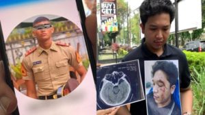 Anak Taruna Akmil Aniaya Mahasiswa Kedokteran Dan Tawarkan Uang Damai  RP 15 Juta
